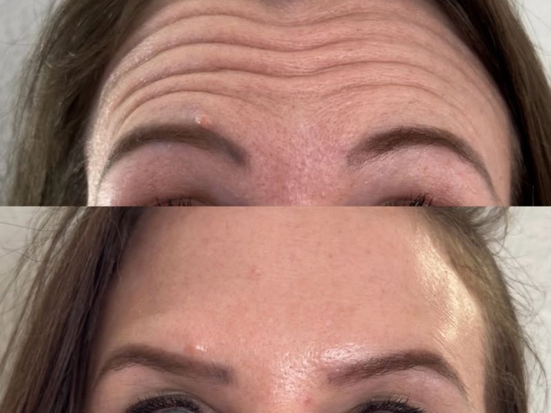 Aesthetic treatment result